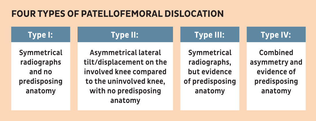 Four Types of Patellofemoral Dislocation